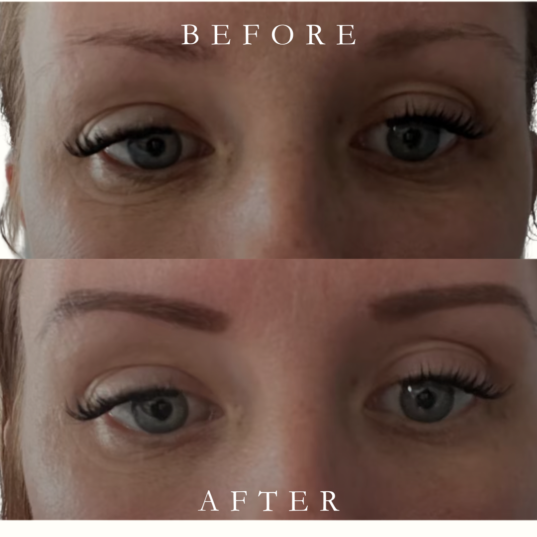 Snow Lift Peptide Under/Hooded Eye Serum