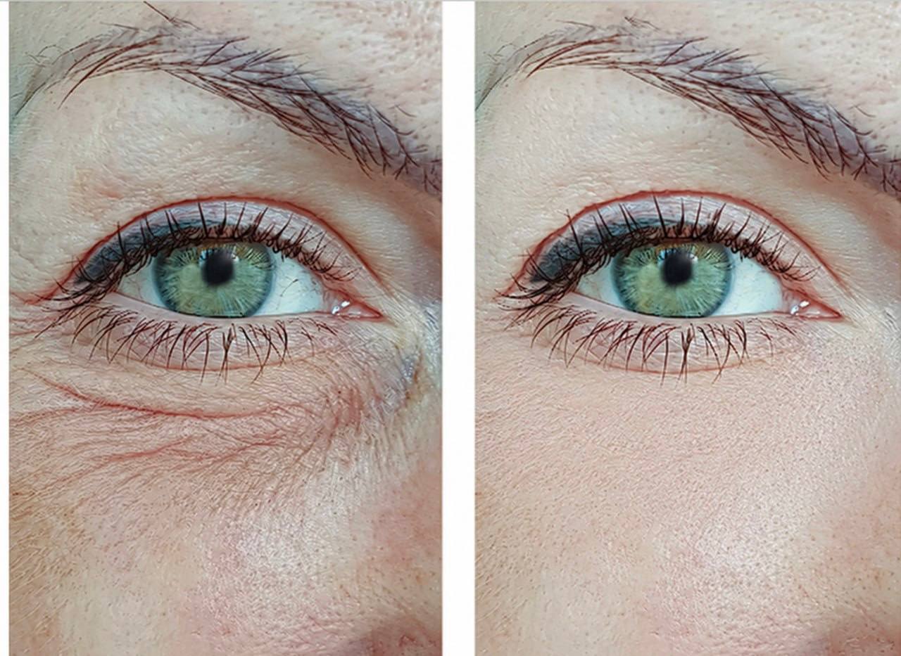 Snow Lift Peptide Under/Hooded Eye Serum – SerenityHue