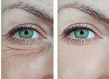 Snow Lift Peptide Under/Hooded Eye Serum