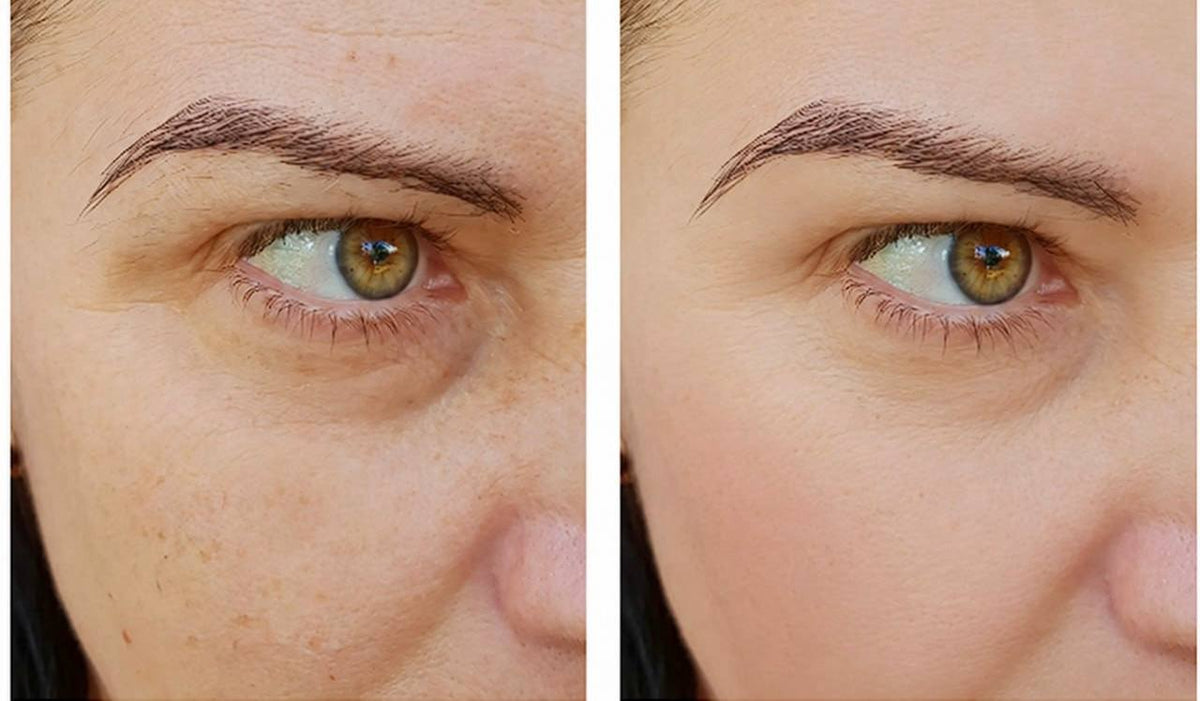 Snow Lift Peptide Under/Hooded Eye Serum