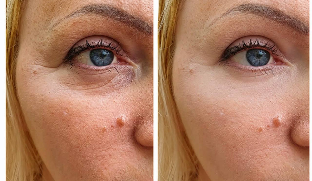 Snow Lift Peptide Under/Hooded Eye Serum