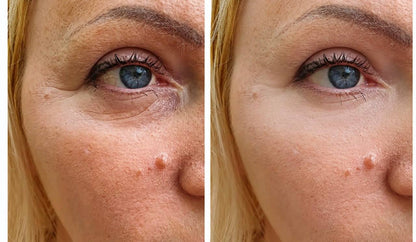 Snow Lift Peptide Under/Hooded Eye Serum