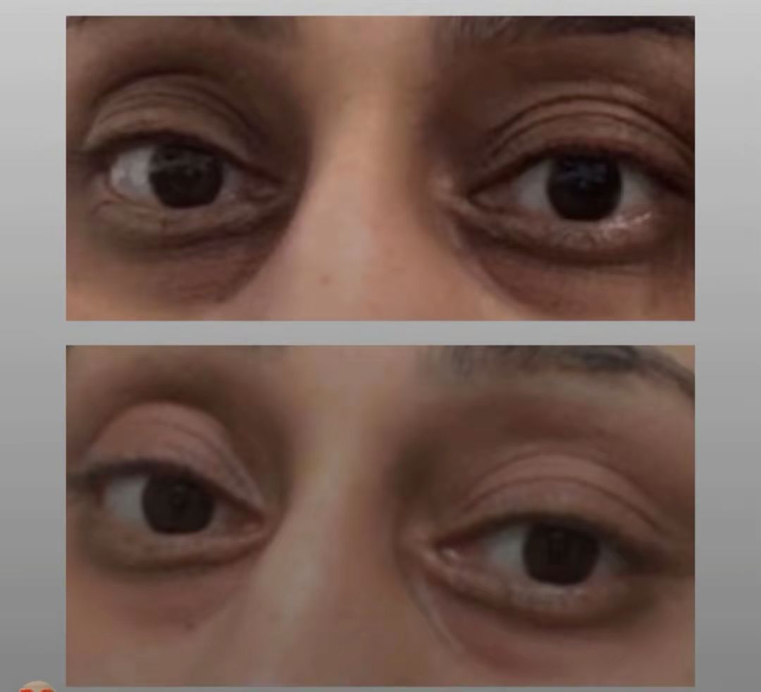 Snow Lift Peptide Under/Hooded Eye Serum